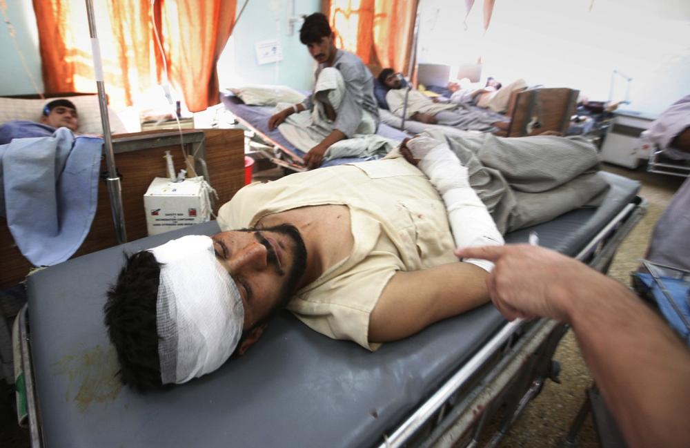 An Afghan man, injured in a suicide attack, lies on a bed at a hospital in Kabul, Afghanistan, on Tuesday. (AP)