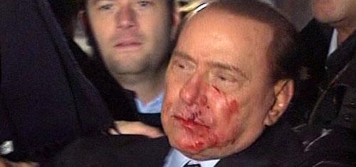 This video image made available by RAI TG3 shows Italian Premier Silvio Berlusconi after an attacker hurled a statuette at Berlusconi striking the leader in the face at the end of a rally in Milan, Italy on Sunday Dec. 13, 2009 leaving the 73-year-old media mogul with a bloodied mouth and looking stunned. (AP)