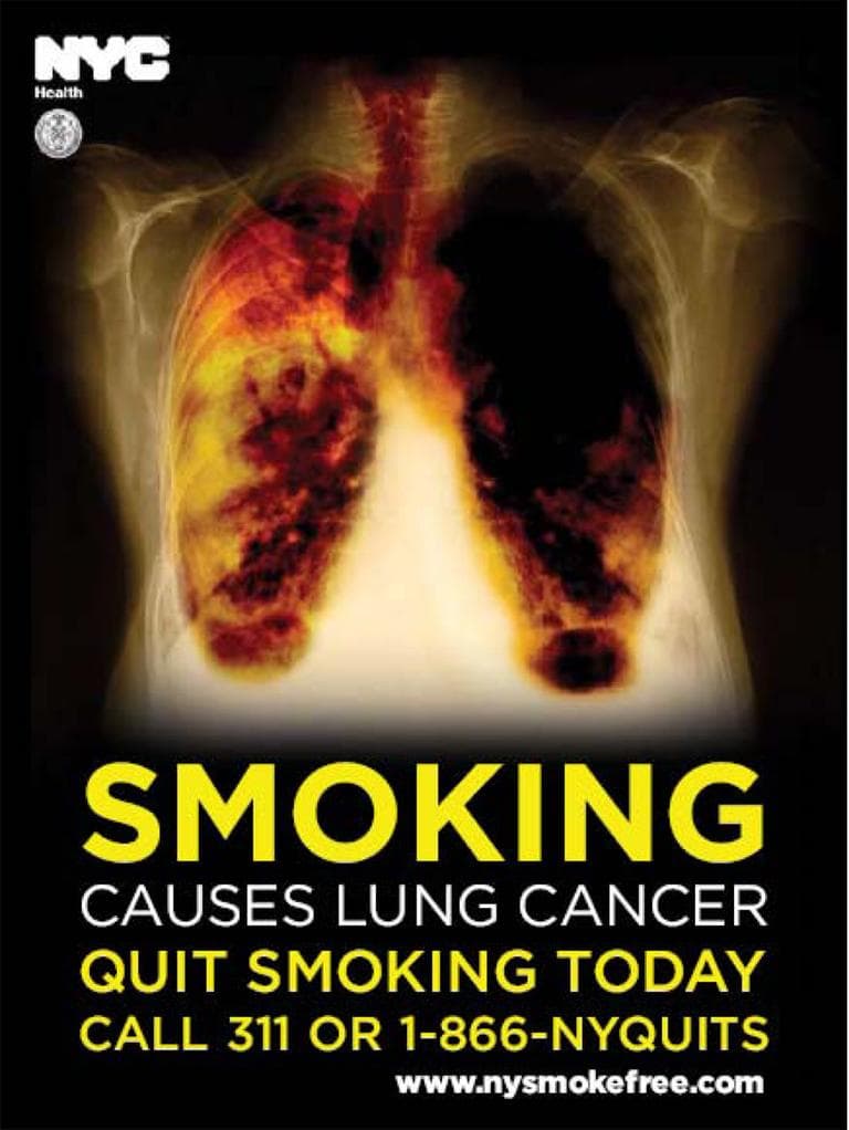State health officials want graphic warnings such as this one, which shows diseased lungs, posted near store tobacco displays.
