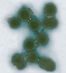 Undated handout image provided by the J. Craig Venter Institute shows negatively stained transmission electron micrographs of aggregated M. mycoides. (AP/J. Craig Venter Institute)
