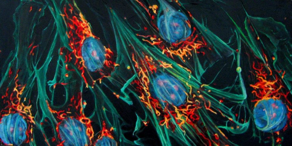 This painting, by Lynda M. Cutrell, reinterprets a slide of mitochondria ravaged by schizophrenia. (Image courtesy Hope M. Riccardi)