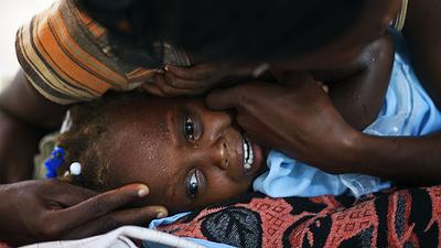 A Haitian child suffers from cholera symptoms