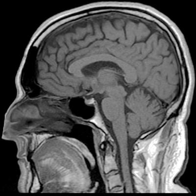 An MRI of a human brain (Reigh LeBlanc/Flickr)