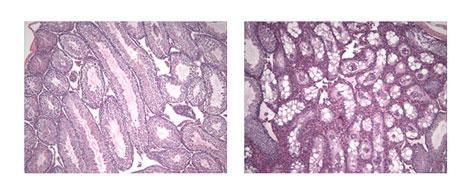 Rejuvenation of testicular tissue after telomerase activation. Left, TERT-ER mouse, not induced; right, TERT-ER mouse, induced. (Dana-Farber Cancer Institute)
