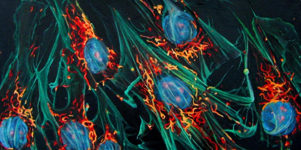 This painting, by Lynda M. Cutrell, reinterprets a slide of mitochondria ravaged by schizophrenia. (Courtesy Hope M. Riccardi)