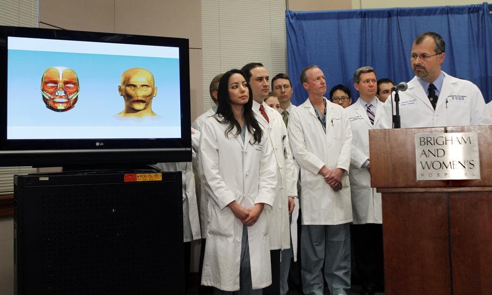 Plastic surgeon Dr. Bohdan Pomahac, far right,  in a news conference at Brigham and Women's Hospital in Boston on Monday, March 21, 2011, to discuss his team's completion of the first full face transplant in the U.S. (AP) 