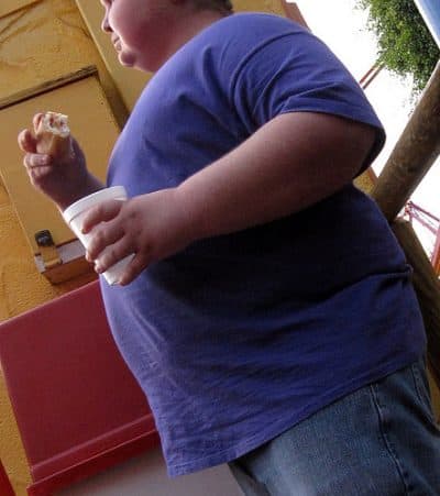 obese kid