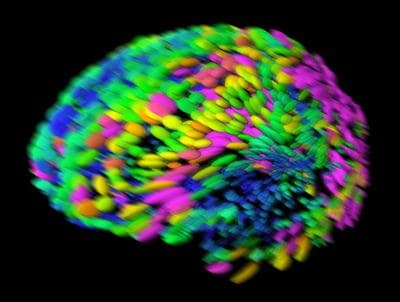 Template brain used to assist in the study of anatomical brain differences. (National Science Foundation)
