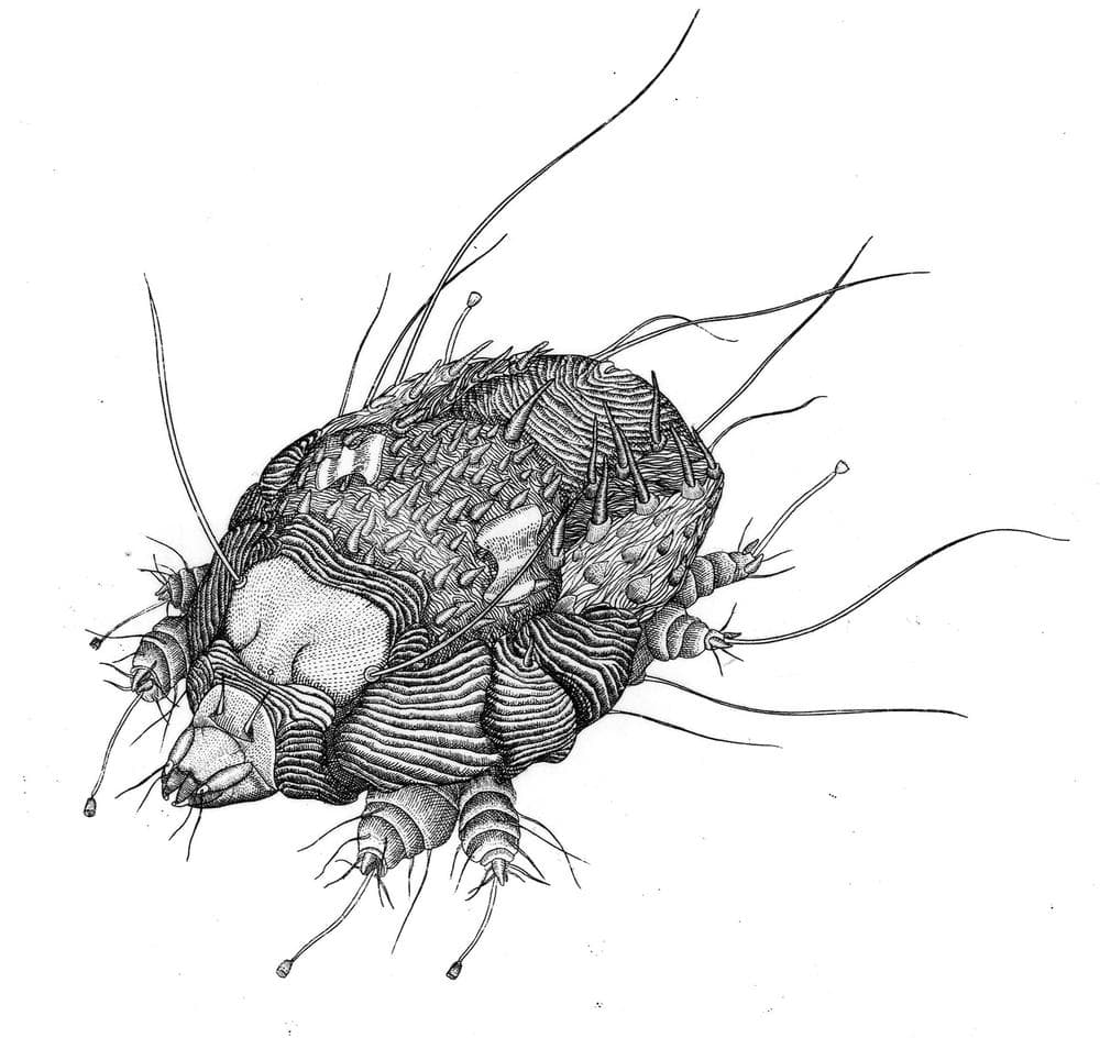 Scabies Mite (Copyright Briony Morrow-Cri​bbs, from the book &quot;Wicked Bugs,&quot; courtesy of Algonquin Books)