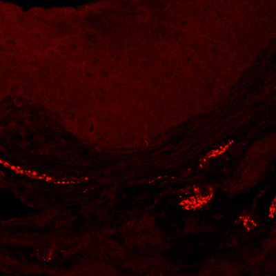 The mouse vagina: in red are nerve fibers in a state of hypersensitivity after exposure to several yeast infections.