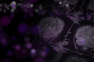 Fade To Darkness: The Age Of Alzheimer's