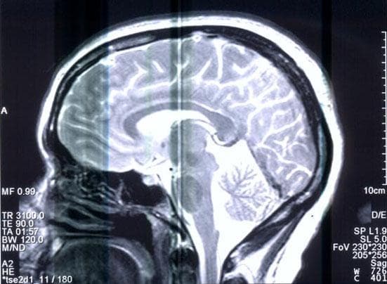 A brain scan. (Courtesy of dreamattack/Flickr)