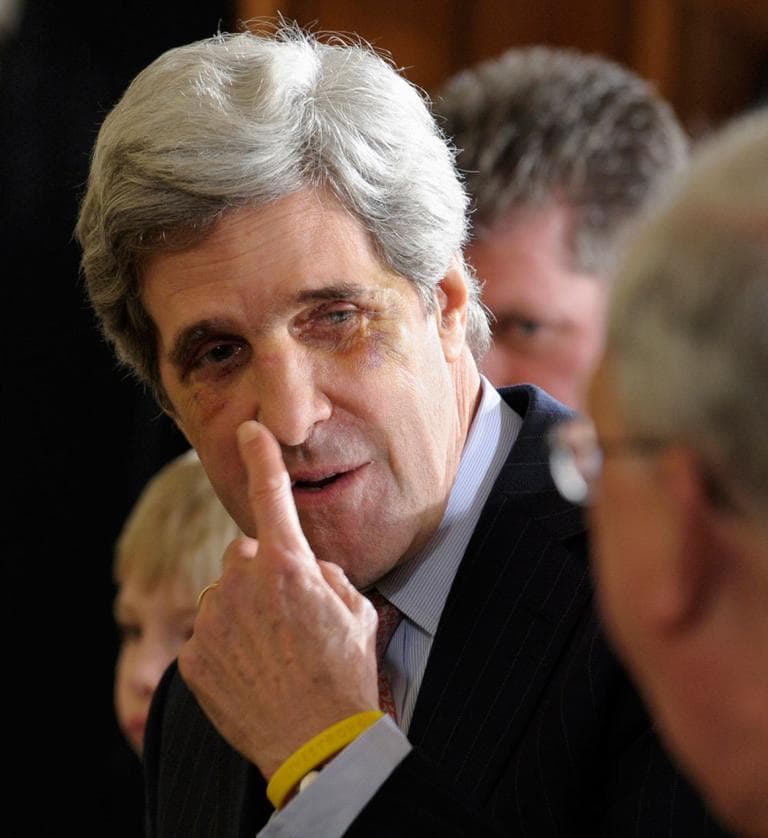 At the ceremony, Sen. John Kerry had a broken nose, which he said he hurt playing hockey. (AP)