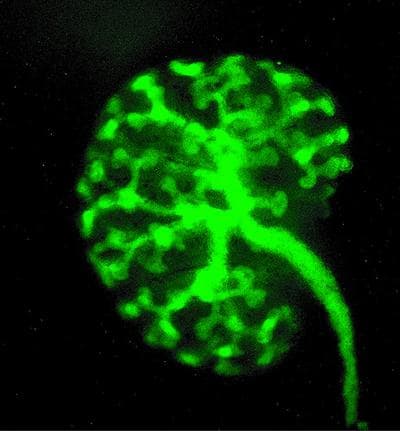 New research finds links between the humble kidney and our brains. Shown here is the kidney of an embryonic mouse, genetically altered to glow green.
