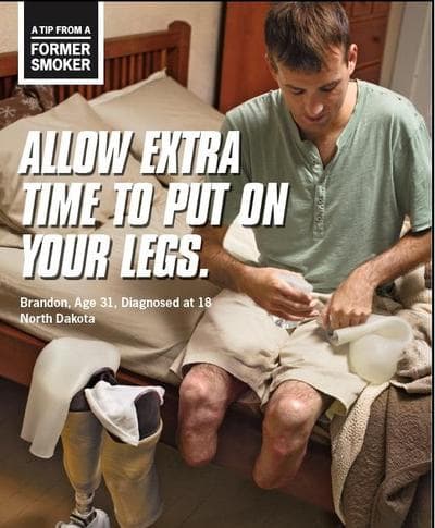 The CDC launched a graphic ad campaign on the grim effects of smoking. (CDC)