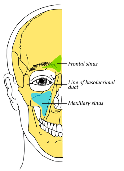  Reproduction of a lithograph plate of the paranasal sinuses from Gray's Anatomy (Wikipedia Commons)