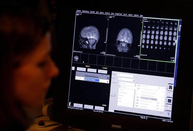 A freezer meltdown at the Harvard Brain Tissue Resource Center could lead to serious setbacks in Autism research (AP).