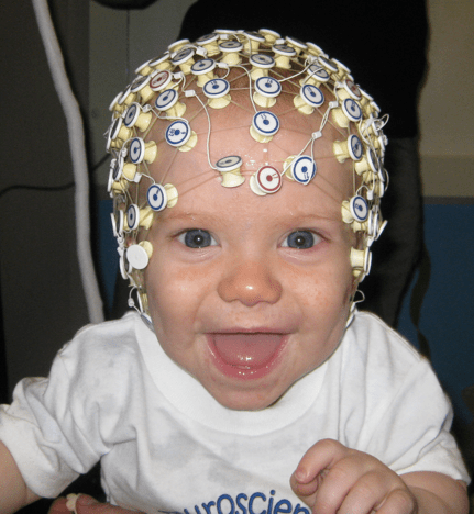 A baby in an EEG cap at Boston Children's Hospital