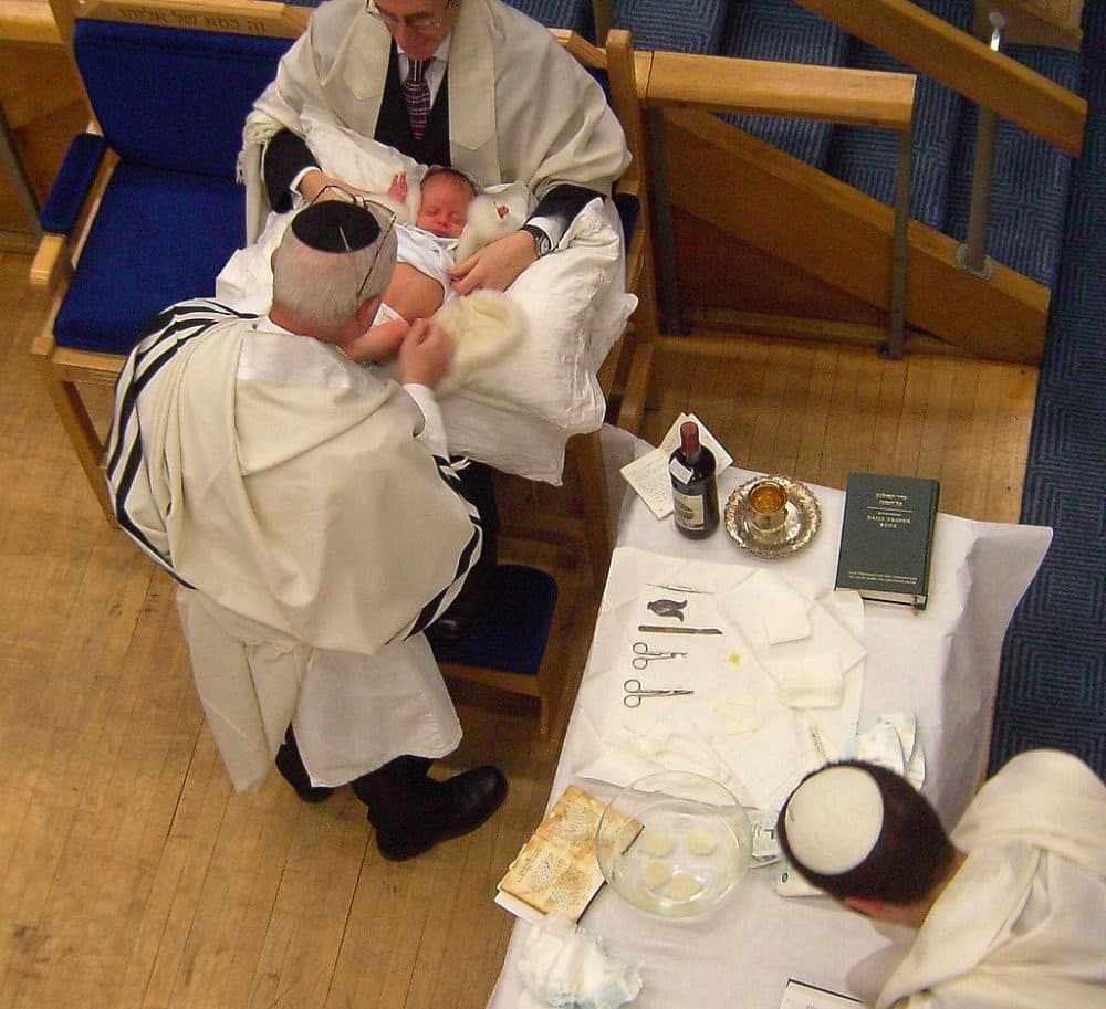 Preparing for a ritual circumcision