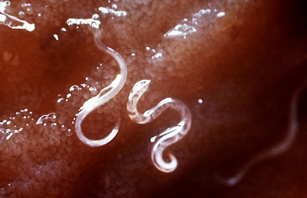 Hookworm attached to the intestinal mucosa. (CDC’s Public Health Image Library via Wikimedia Commons)