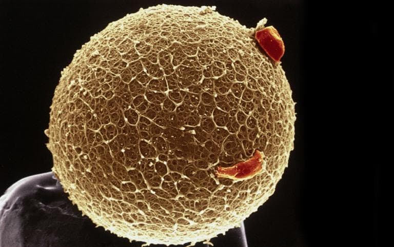 Colour-enhanced scanning electron micrograph of a human egg by Yorgos Nikas. (Flickr)