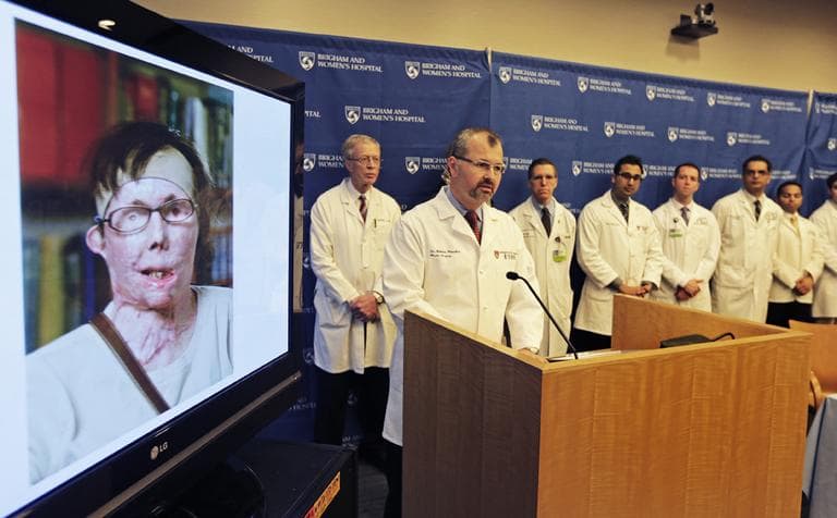 Dr. Bodhan Pomahac, at podium, with his surgical team, speaks to reporters regarding the face transplant of Carmen Blandin Tarleton, pictured left, at Brigham and Women&#039;s Hospital in Boston on Wednesday.(Charles Krupa/AP)