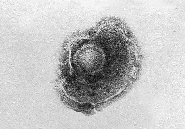 Electron Micrograph of Varicella Virus. (CDC Public Health Image)