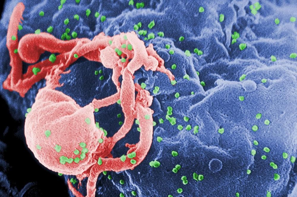 Scanning electron micrograph of HIV-1 budding (in green) from cultured lymphocyte. (Wikipedia)