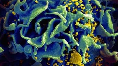 HIV particles, yellow, infect an immune cell, blue. (NIAID_Flickr)