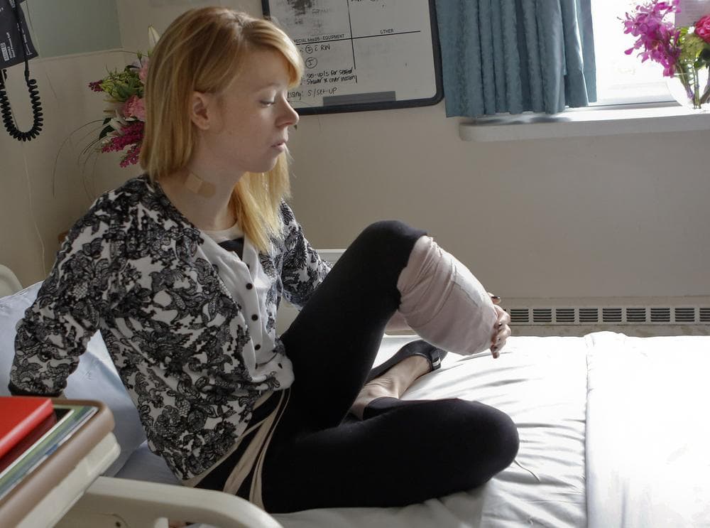 Adrianne Haslet, a a professional ballroom dancer injured by one of the bombs that exploded near the Boston Marathon finish line, lifts her bandaged left leg in her bed at Spaulding Rehabilitation Hospital in Boston, Wednesday, April 24, 2013.  Haslet, who lost her left foot and part of her lower leg, vows that she will dance again.  (AP Photo/Bizuayehu Tesfaye)