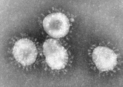 Coronoviruses (these are not the new Middle East virus) are a group of viruses that have a halo, or crown-like (corona) appearance when viewed under an electron microscope. (Wikimedia Commons)