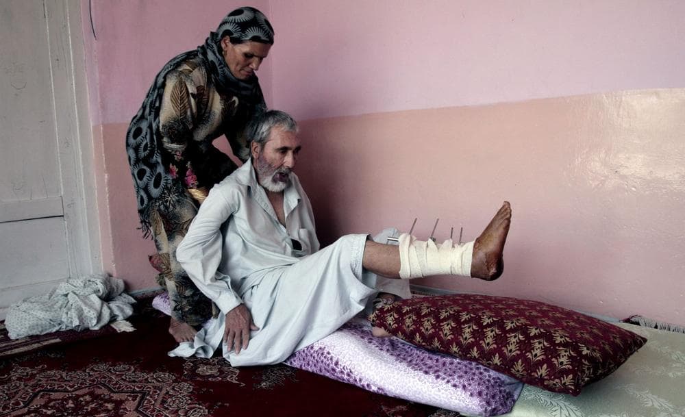 Abdul Jamil, 55, a suicide attack victim who suffers from injuries on his right leg and lost his left eye, is helped by his wife at his home, in Kabul, Afghanistan, Wednesday, July 31, 2013. (Rahmat Gul/AP)