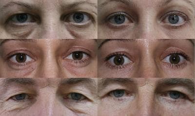Work by a Saint Petersburg cosmetic surgeon on Wikimedia Commons