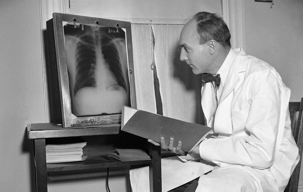 Dr. T. Royle Dawber, was the director of the Framingham Heart Study, from 1949-1966. He checks an X-Ray in his office on April 7, 1952. (Frank C. Curtin/AP)