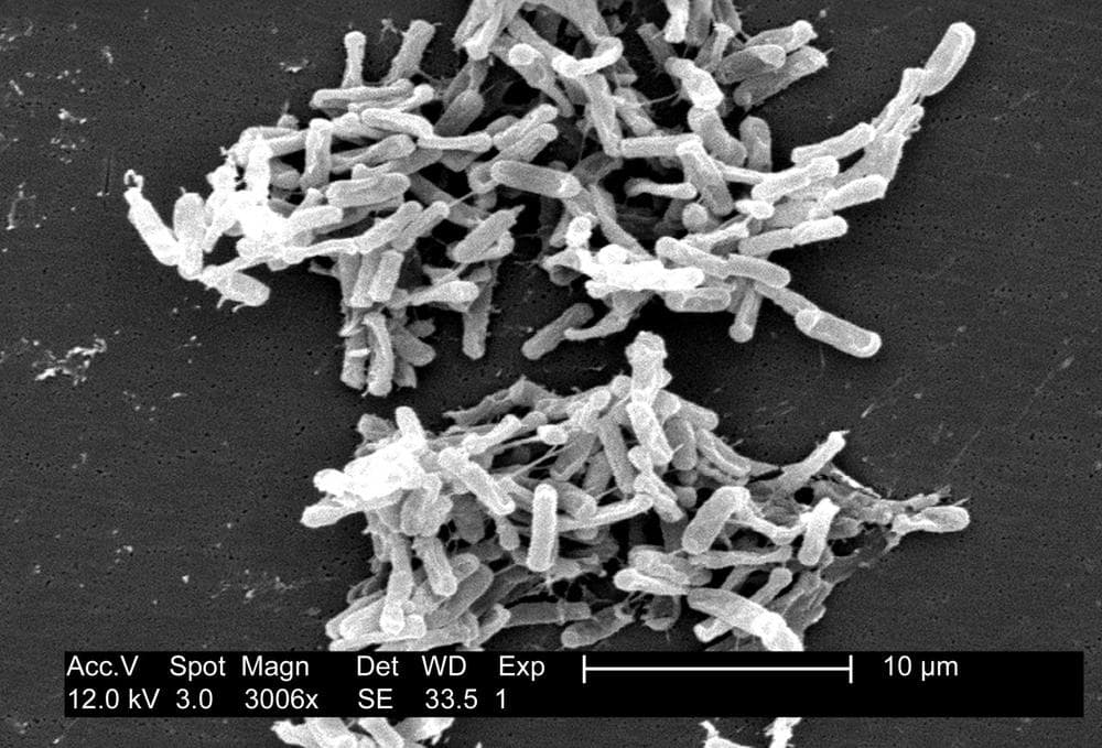 A scanning electron micrograph of Clostridium difficile, bacteria that the CDC's new report on antibiotic resistant bacteria calls an &quot;urgent threat.&quot; (CDC via Wikipedia)