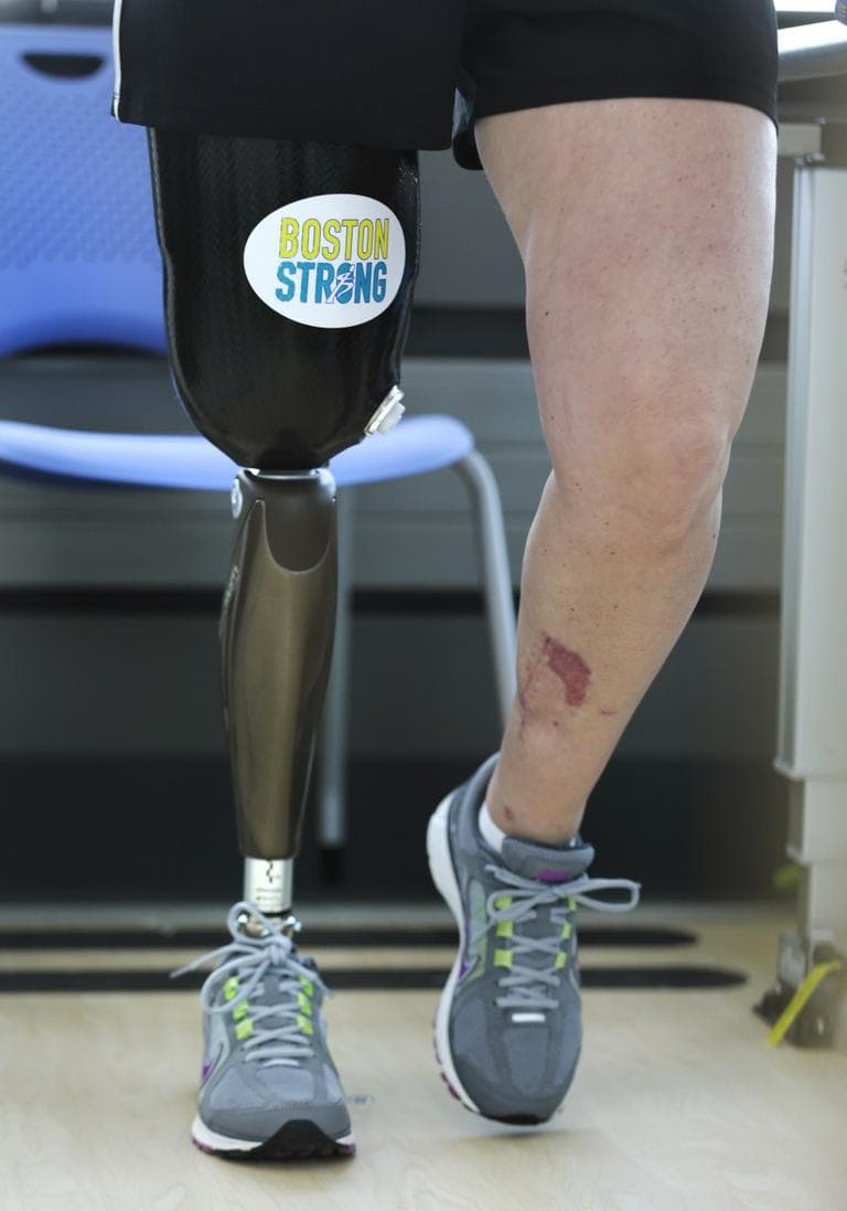 With a &quot;Boston Strong&quot; sticker on the thigh covering of her prosthetic leg, Boston Marathon bombing survivor Roseann Sdoia walks between parallel bars at the Spaulding Rehabilitation Hospital in June. (Charles Krupa/AP)