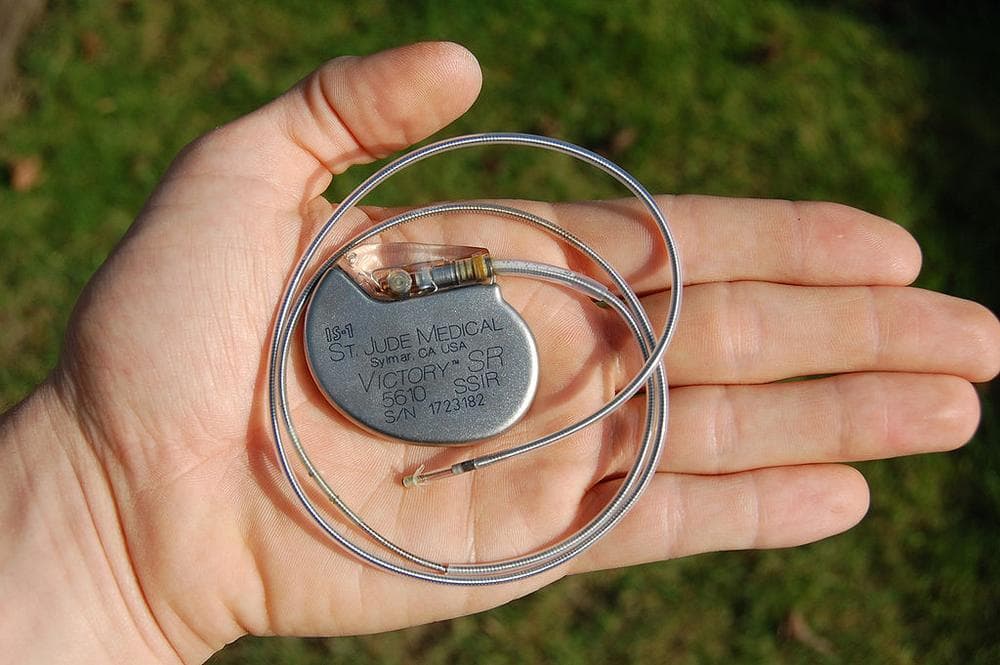 A pacemaker device that had been removed from a deceased patient. (Steven Fruitsmaak/Wikimedia Commons)