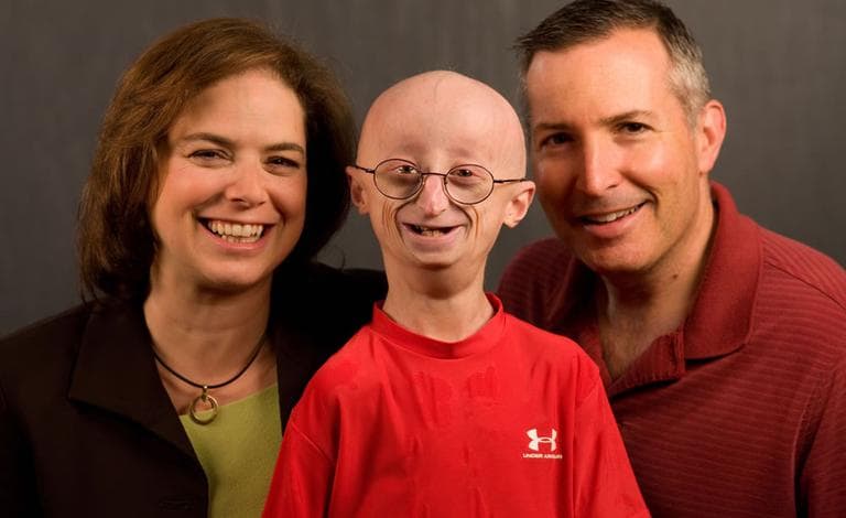 Sam Berns with his parents Leslie Gordon and Scott Berns. When sam was diagnosed with progeria, Gordon immersed herself in studying progeria’s cause, possible treatments and the search for a cure.(Courtesy Fine Films)