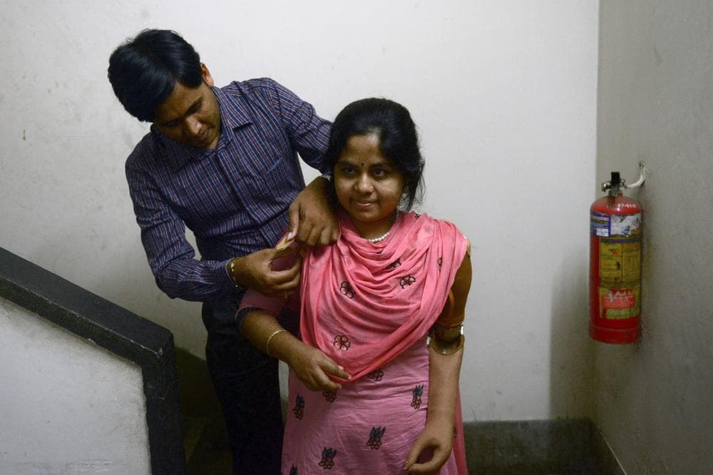 Bangladeshi garment worker Laboni, who worked at the Rana Plaza, is assisted by her husband in puttng on herprosthetic hand at a hospital in Dhaka November 23, 2013. A $40 million fund is being created to compensate the injured and victims' families. (Munir Uz Zaman/AFP/Getty Images)