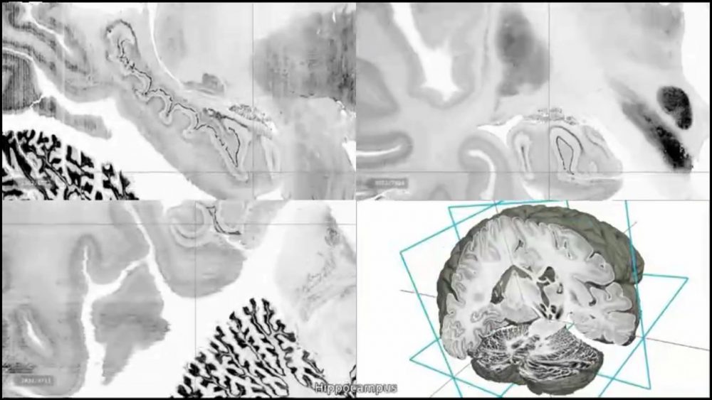 This image made from video provided by researchers shows a highly-detailed image of the hippocampus region of the human brain. The digital three-dimensional model called &quot;BigBrain&quot; was produced from the thousands of sections made from the brain of a 65-year-old woman. Its resolution is finer than a human hair, so it can reveal clusters of brain cells and even some large individual cells. (AP)