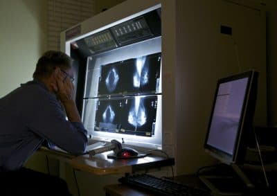 A radiologist checks mammograms, an advanced imaging screening that promotes early detection of breast cancer, at The Elizabeth Center for Cancer Detection in Los Angeles, May. 6, 2010. (Damian Dovarganes/AP)