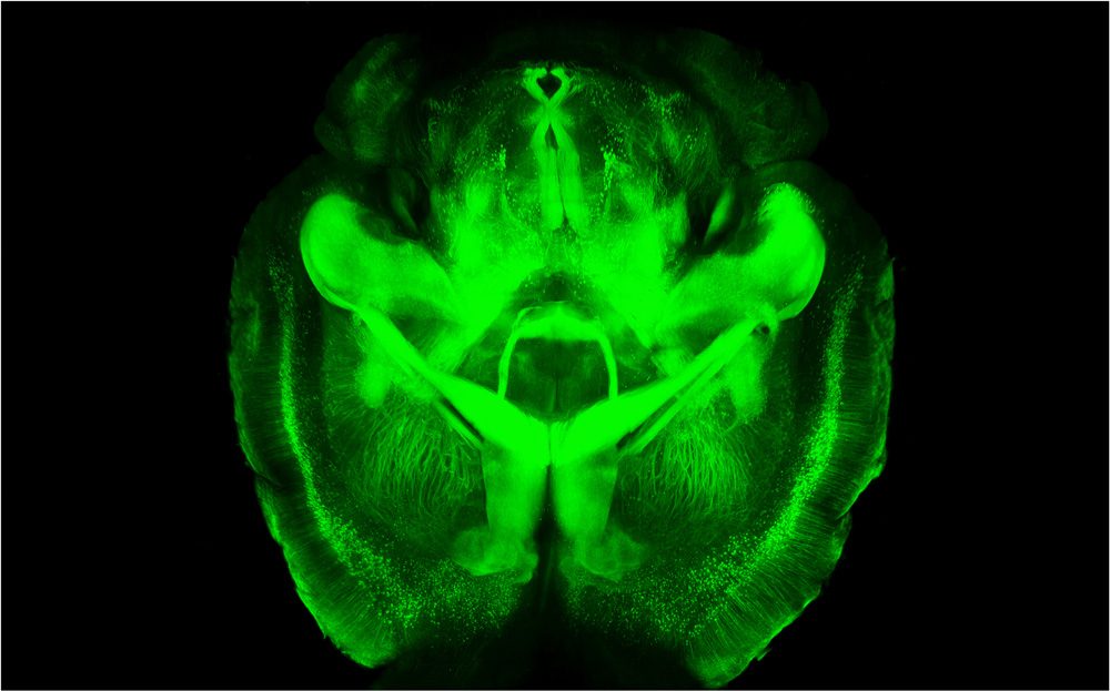 This is a mouse brain that scientists made transparent using a new technique called CLARITY. First, they infused the brain with a gel that bound to the brain's proteins and held them in place. Then, the scientists flushed out all the opaque fatty tissue from the brains, leaving them structurally intact but transparent. Using this technique, scientists can study the three-dimensional structure of brains without having to cut them apart. (Courtesy of Karl Deisseroth/Stanford University)