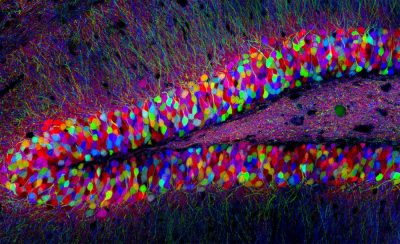 This is a part of a mouse brain called the dentate gyrus. It is located in the brain’s hippocampus, a region involved in memory formation. This mouse was genetically engineered to express fluorescent proteins of varying color combinations in its neurons. This labeling process, called Brainbow, allows scientists to more easily distinguish individual cells and connections in the brain. (Courtesy of Livet, Weissman, Sanes and Lichtman/Harvard University)