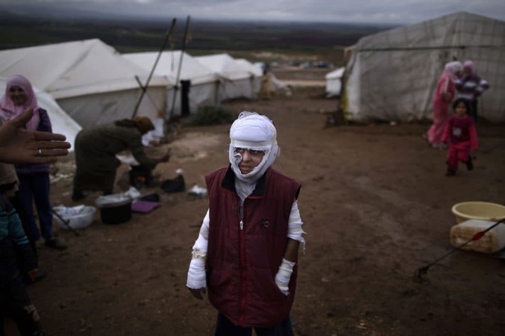 In this Dec. 11, 2012 photo, Abdullah Ahmed, 10, who suffered burns in a Syrian government airstrike and fled his home with his family, stands outside their tent at a camp for displaced Syrians in the village of Atmeh, Syria. (Muhammed Muheisen/AP)