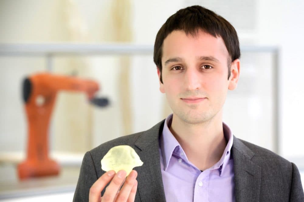 Steven Keating has 3-D printed versions of his tumor, that took up 10 percent of his brain. (Courtesy Steven Keating, photo by Paula Aguilera &amp; Jonathan Williams)