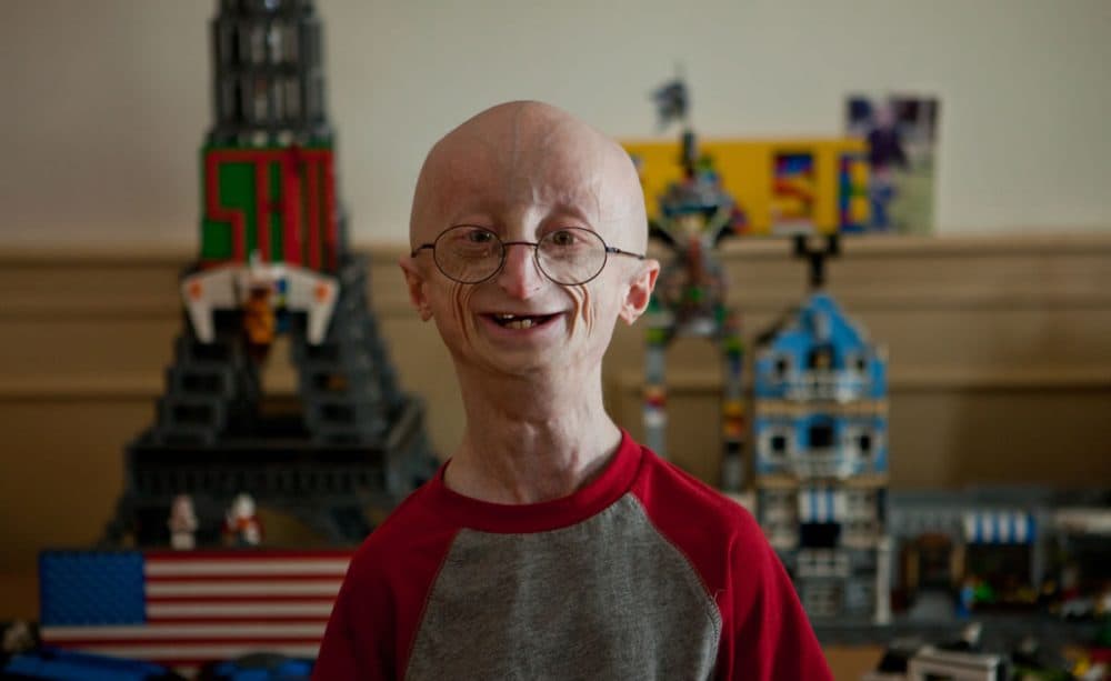 Sam Berns, who died in 2014 at age 17 from complications of the rare genetic disease progeria, was known for his philosophy for living a happy life and how he didn't let the obstacles presented by his disease stop him from achieving his dreams. (Courtesy Fine Films)