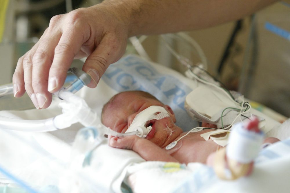 In this file photo, an infant is seen in the neonatal intensive care unit of the Swedish Medical Center in Seattle. (Paul Joseph Brown/AP)
