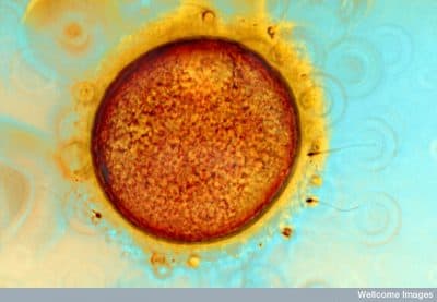 Human egg and sperm
(Photo: Spike Walker. Wellcome Images, via Flickr Creative Commons)
