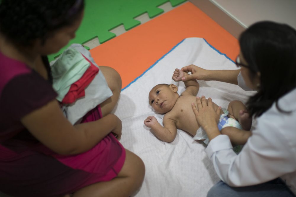Jaqueline Vieira, left, watches as her 3-month-old son Daniel, who was born with microcephaly, undergoes physical therapy at the Altino Ventura foundation in Recife, Brazil. (AP Photo/Felipe Dana)