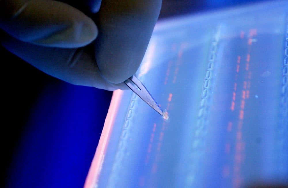 A lab officer cuts a DNA fragment under UV light from an agarose gel for DNA sequencing on April 19, 2007 in Singapore. (Wong Maye-E/AP)